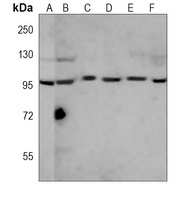 Anti-RANBP9 Antibody