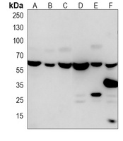 Anti-BBS4 Antibody