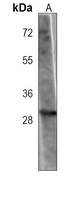 OR5B12 antibody