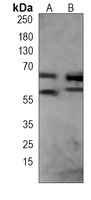 FUBP3 antibody