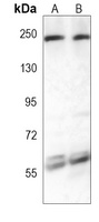 Anti-XRN1 Antibody