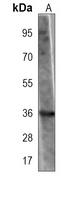 MYO18B antibody
