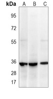Anti-LIN28B Antibody