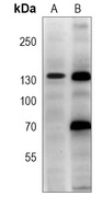 Anti-TRK C Antibody