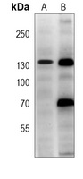 TRK C antibody