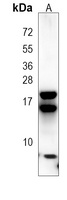 Anti-REG3 gamma Antibody