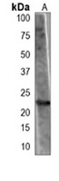 Anti-BAD (Phospho-S155) Antibody
