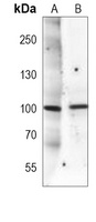 Anti-MUSK Antibody