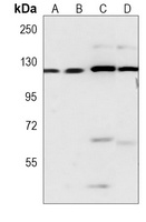 DAB2IP antibody
