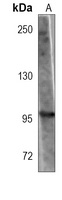 Anti-CD167b Antibody