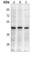 Anti-PDK4 Antibody