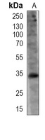 Anti-BOB1 Antibody