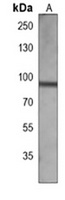 TRK B antibody