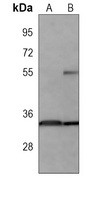 Anti-HUR Antibody