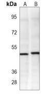Anti-PDK2 Antibody