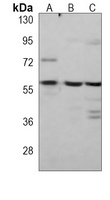 Anti-Caspase 8 Antibody
