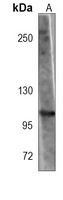Anti-MVP Antibody