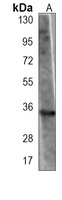 Anti-GNMT Antibody