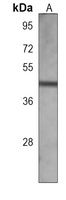 Anti-IHH Antibody
