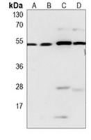Anti-Beclin-1 Antibody
