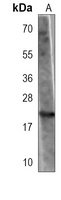 Anti-PNOC Antibody