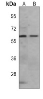 Anti-AMPK alpha 1 Antibody