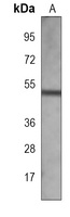 Anti-AKAP13 Antibody