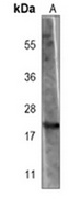 Anti-BAX Antibody