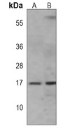 Anti-IFITM3 Antibody