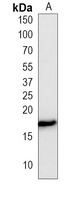 Anti-Histone H3 (Phospho-S10) Antibody