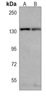 RBM6 antibody
