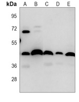 Alpha-actin-1 antibody