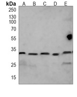 RPS6 antibody