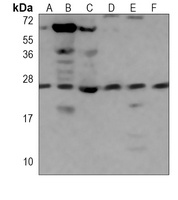 RAB11A antibody