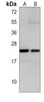 Anti-RRAS2 Antibody