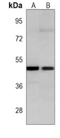 TGF beta 2 antibody