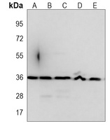 Anti-WNT4 Antibody