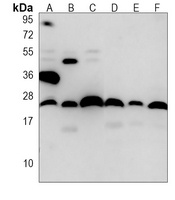 Anti-BID Antibody