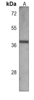 Anti-METAP1 Antibody
