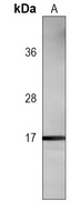 Anti-HMGA2 Antibody
