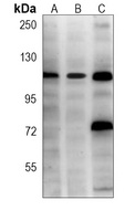 Anti-Hexokinase 2 Antibody