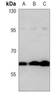 MMP14 antibody