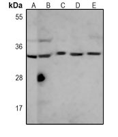 Anti-SULT1A1 Antibody