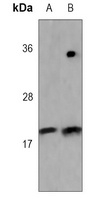 Anti-FHIT Antibody