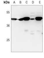 VEGFC antibody