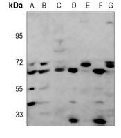 NR2C2 antibody