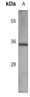 Anti-GNPDA1 Antibody