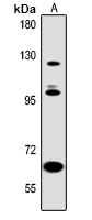 Anti-ABL2 Antibody