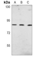 Anti-GlyRS Antibody
