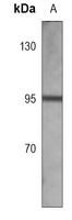 Anti-AREB6 Antibody